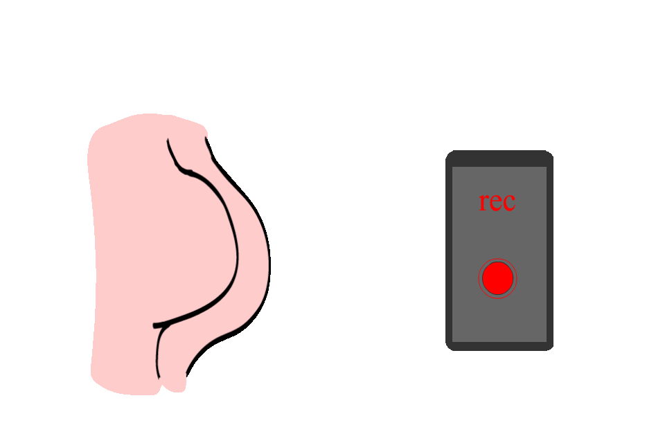 Step 1 Image