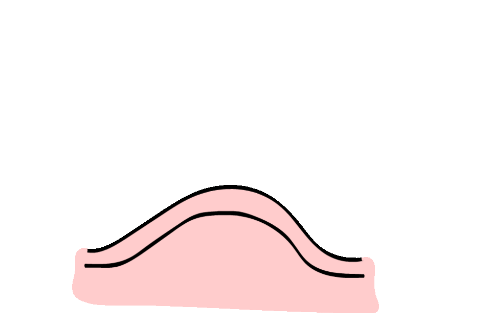 Step 2 Image